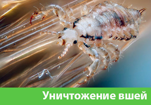 Уничтожение вшей в городе Азнакаево